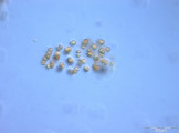 Chroococcus_limneticus_1235048802