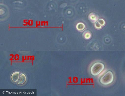 Cyanobacteria Cyanobacteria Chroococcales Chroococcus limneticus