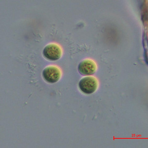 Chroococcus limneticus