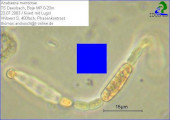 Anabaena_mendotae_1238665470