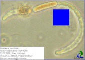 Anabaena_mendotae_1238665598