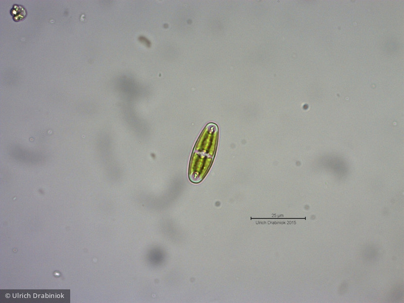 Chlorophyta Conjugatophyceae Desmidiales Closterium navicula
