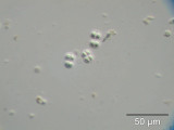 Chroococcus_obliteratus_1236681893