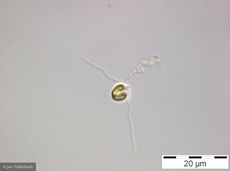 Chrysochromulina_parva_1222441868 - Haptophyta Haptophyceae Prymnesiales Chrysochromulina parva