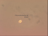 Chrysochromulina_parva_1226581977