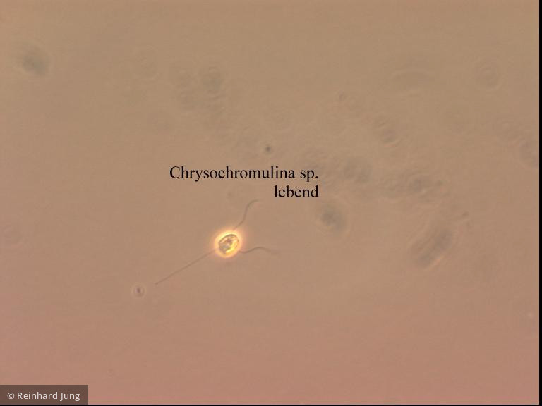 Chrysochromulina_parva_1226581977 - Haptophyta Haptophyceae Prymnesiales Chrysochromulina parva