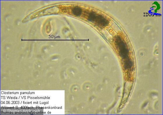 Closterium_parvulum_1238657827 - Chlorophyta Conjugatophyceae Desmidiales Closterium parvulum