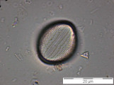 Cocconeis_pediculus_1229086007