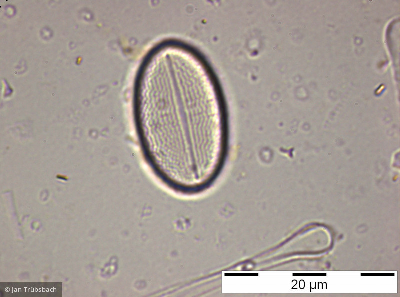 Cocconeis_placentula_1229088771 - Heterocontophyta Bacillariophyceae Pennales Cocconeis placentula