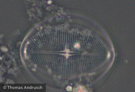 Heterocontophyta Bacillariophyceae Pennales Cocconeis placentula