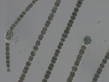 Anabaena_planctonica_1231923757