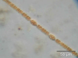 Anabaena_planctonica_1260797122