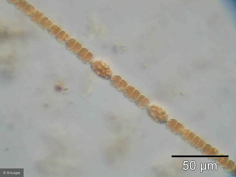 Anabaena_planctonica_1260797122 - Cyanobacteria Cyanobacteria Nostocales Dolichospermum planctonicum
