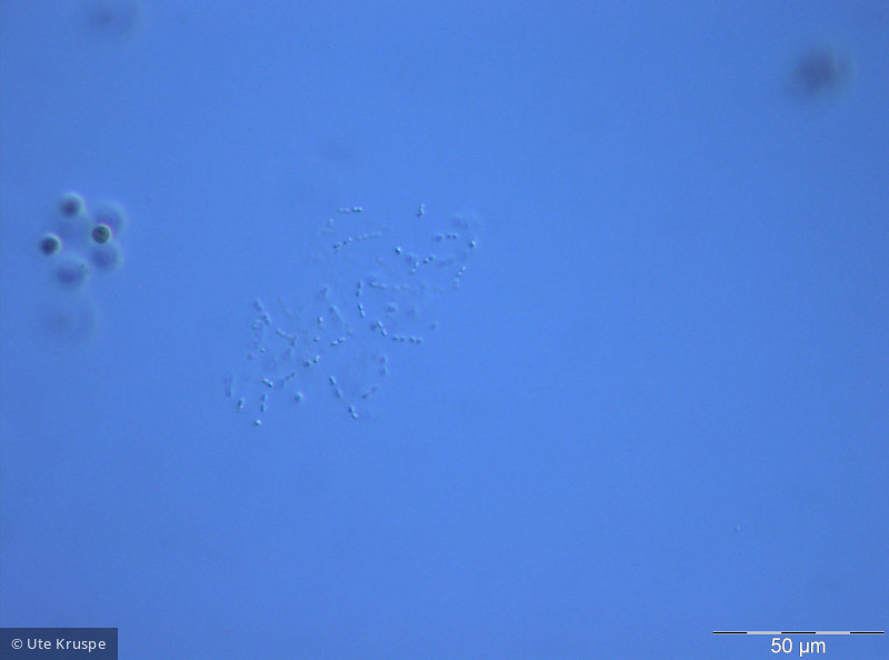 Cyanodictyon_planctonicum_1237274662 - Cyanobacteria Cyanobacteria Chroococcales Cyanodictyon planctonicum