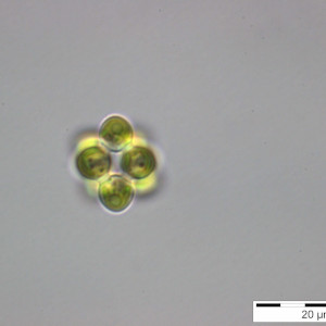 Coelastrum_pseudomicroporum_1255351453