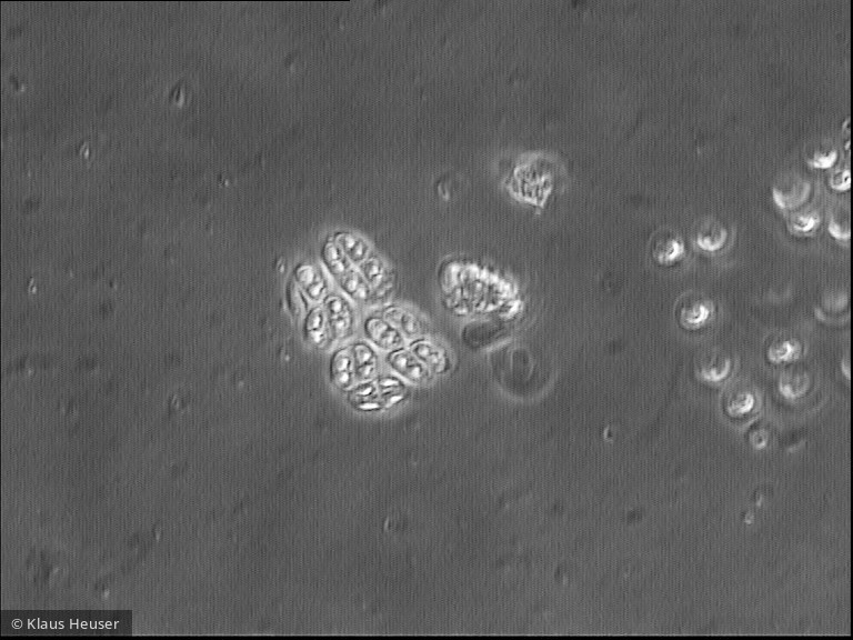 Crucigeniella_rectangularis_1225977004 - Chlorophyta Chlorophyceae Chlorococcales Willea rectangularis