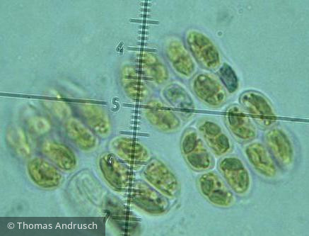 Crucigeniella_rectangularis_1271442691 - Chlorophyta Chlorophyceae Chlorococcales Willea rectangularis