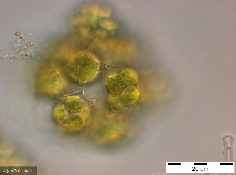 Coelastrum_reticulatum_1255958160 - Chlorophyta Chlorophyceae Chlorococcales Hariotina reticulata
