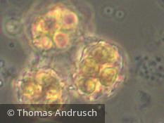 Chlorophyta Chlorophyceae Chlorococcales Hariotina reticulata