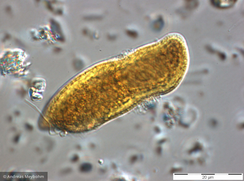 Cryptomonas_rostratiformis_1270559515 - Cryptophyceae Cryptophyceae Cryptomonadales Cryptomonas curvata