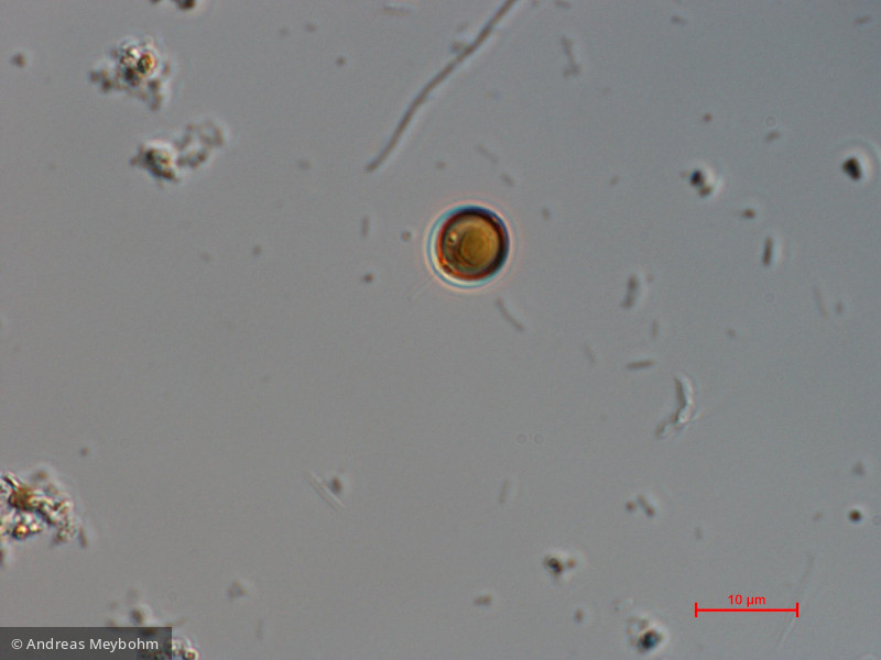 Heterocontophyta Chrysophyceae Chromulinales Chrysococcus rufescens