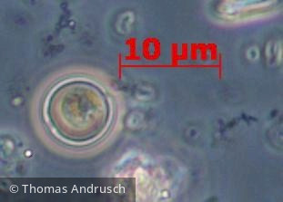 Heterocontophyta Chrysophyceae Chromulinales Chrysococcus rufescens