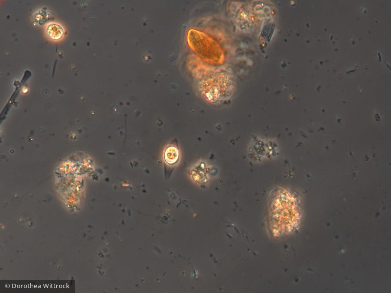 Heterocontophyta Chrysophyceae Stylococcales Chrysopyxis sp.