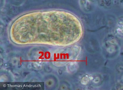 Euglenophyta Euglenophyceae Euglenales Colacium sp.