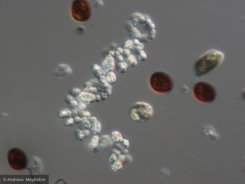 Anabaena_spiroides_1219821502 - Cyanobacteria Cyanobacteria Nostocales Dolichospermum spiroides