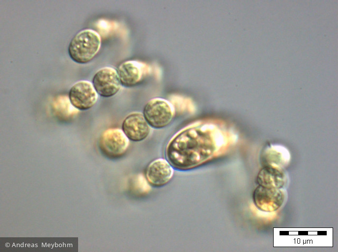 Anabaena_spiroides_1219822122 - Cyanobacteria Cyanobacteria Nostocales Dolichospermum spiroides