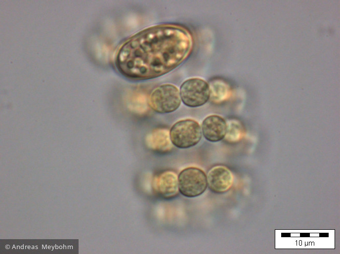 Anabaena_spiroides_1219822475 - Cyanobacteria Cyanobacteria Nostocales Dolichospermum spiroides