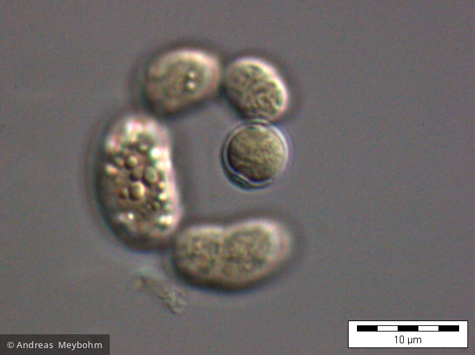 Anabaena_spiroides_1219822664 - Cyanobacteria Cyanobacteria Nostocales Dolichospermum spiroides