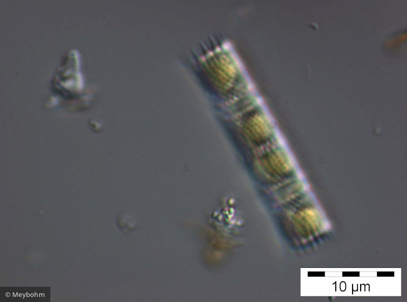 Aulacoseira subarctica &middot; Heterocontophyta Bacillariophyceae Centrales