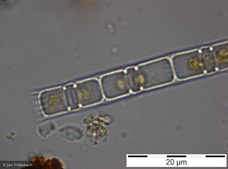 Aulacoseira subarctica &middot; Heterocontophyta Bacillariophyceae Centrales &middot; 1500x