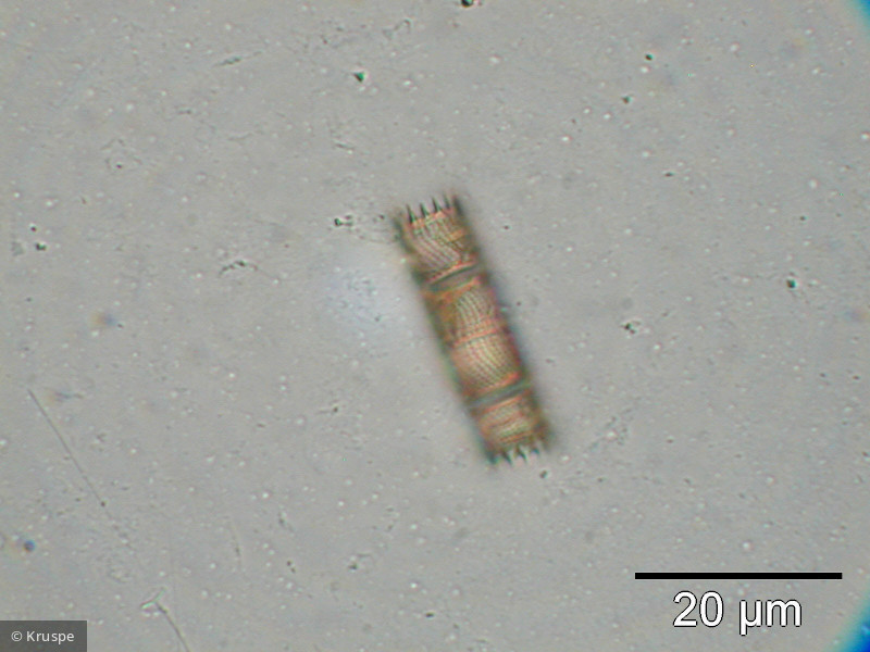 Aulacoseira subarctica &middot; Heterocontophyta Bacillariophyceae Centrales &middot; 1000x