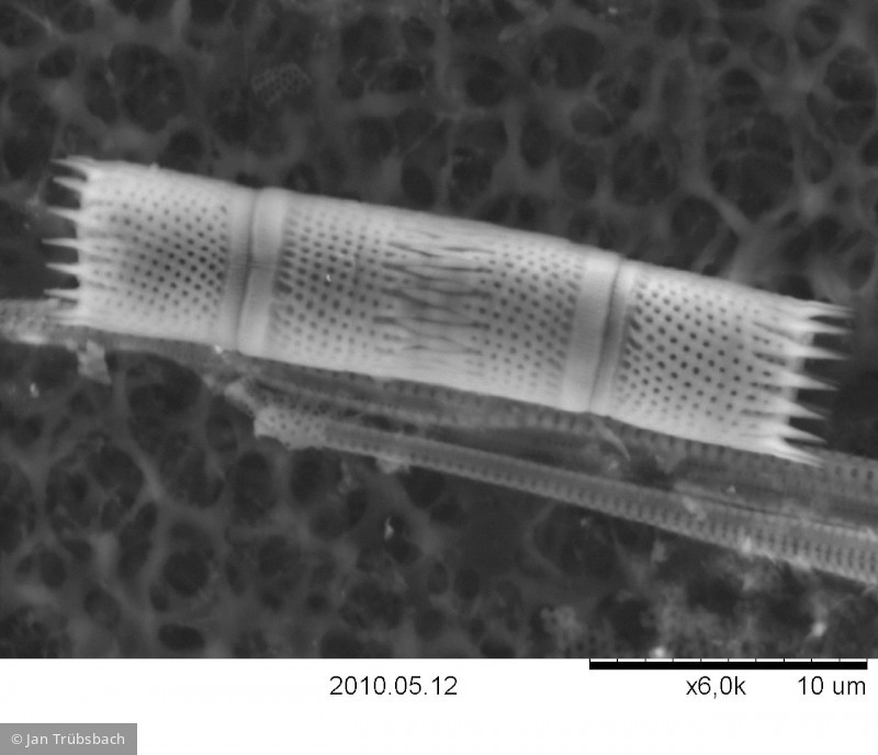 Aulacoseira subarctica &middot; Heterocontophyta Bacillariophyceae Centrales &middot; 6000x