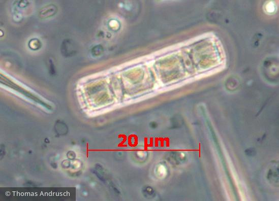 Aulacoseira subarctica &middot; Heterocontophyta Bacillariophyceae Centrales &middot; 1000x