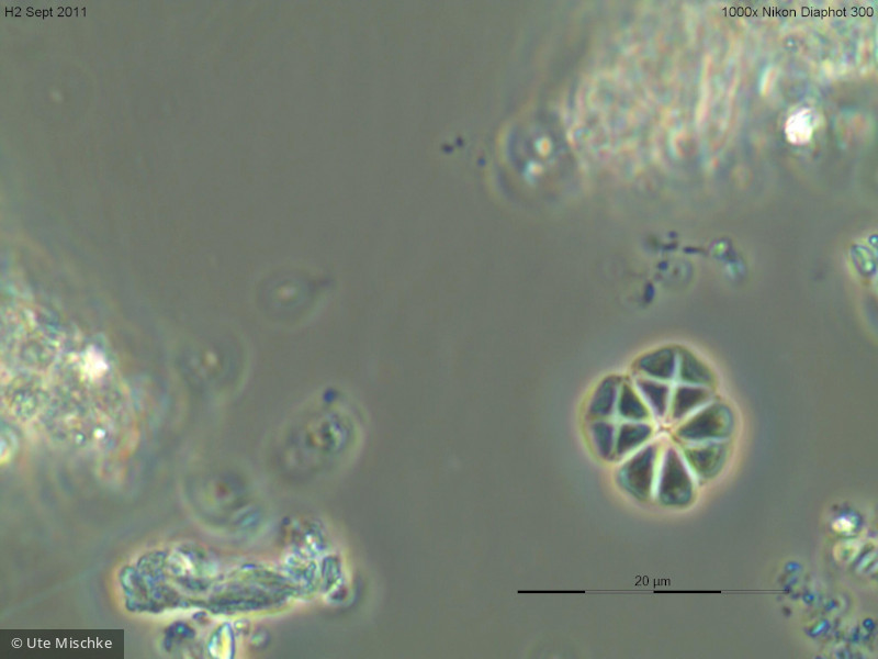 Chlorophyta Chlorophyceae Chlorococcales Lemmermannia tetrapedia