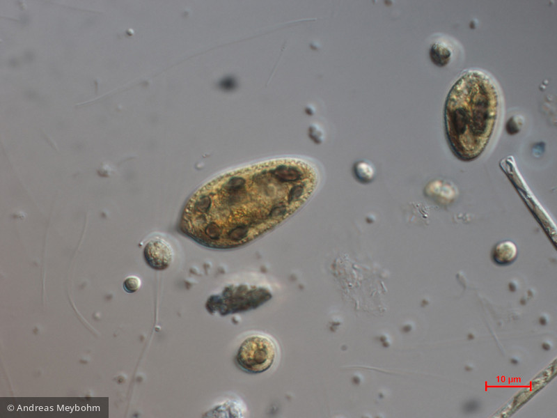 Cryptomonas_tetrapyrenoidosa_1271150377 - Cryptophyceae Cryptophyceae Cryptomonadales Cryptomonas tetrapyrenoidosa