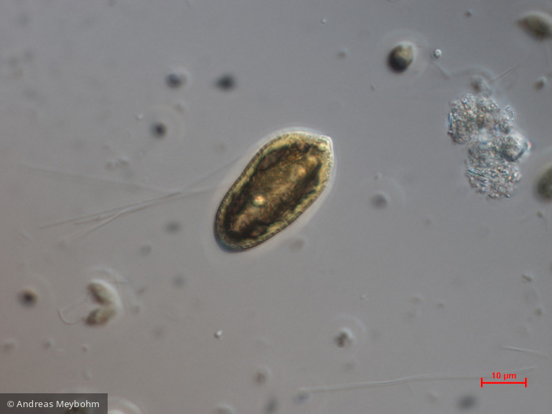 Cryptomonas_tetrapyrenoidosa_1271151037 - Cryptophyceae Cryptophyceae Cryptomonadales Cryptomonas tetrapyrenoidosa