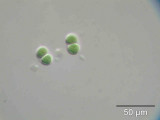 Chroococcus_turgidus_1237282901
