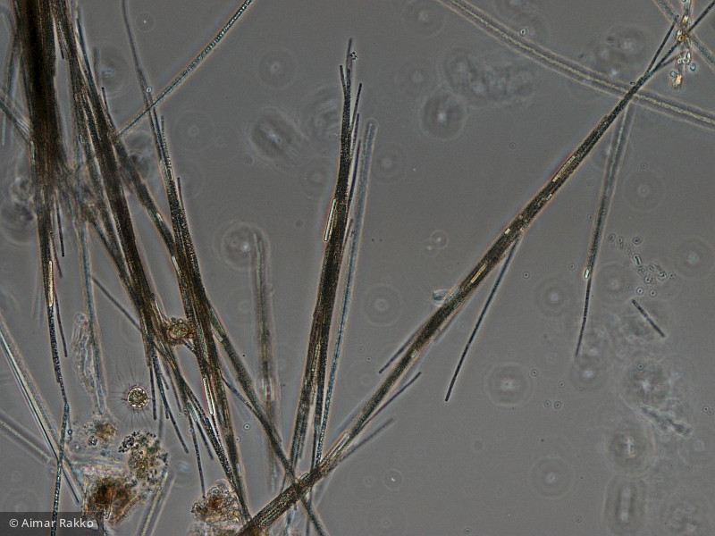 Aphanizomenon_yezoense_1231923592