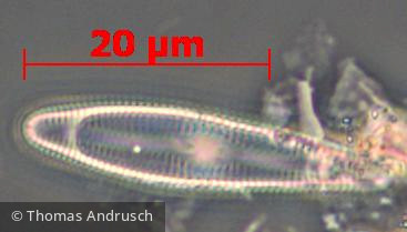 Heterocontophyta Bacillariophyceae Pennales Rhoicosphenia abbreviata