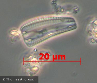 Heterocontophyta Bacillariophyceae Pennales Rhoicosphenia abbreviata