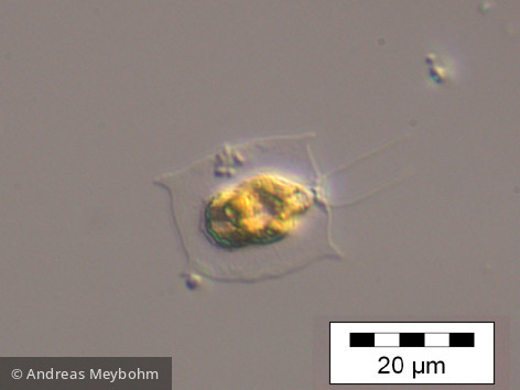 Pteromonas_aculeata_1234533911 - Chlorophyta Chlorophyceae Volvocales Pteromonas aculeata