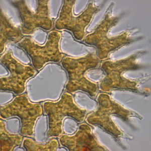 Pediastrum_biradiatum var. biradiatum_1250494725
