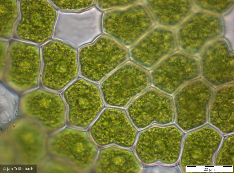 Chlorophyta Chlorophyceae Chlorococcales Pseudopediastrum boryanum