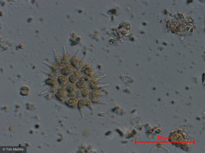 Chlorophyta Chlorophyceae Chlorococcales Pseudopediastrum boryanum