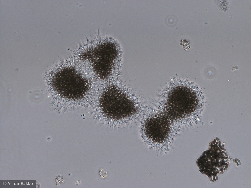 Microcystis_botrys_1231922861 - Cyanobacteria Cyanobacteria Chroococcales Microcystis botrys