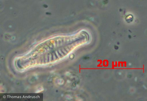 Heterocontophyta Bacillariophyceae Pennales Navicula capitata